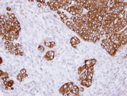 alpha Glucosidase II Rabbit Polyclonal Antibody
