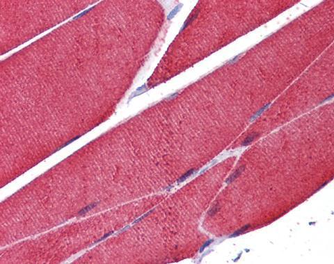 alpha Skeletal Muscle Actin Rabbit Polyclonal Antibody