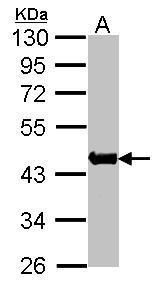 alpha Skeletal Muscle Actin Rabbit Polyclonal Antibody