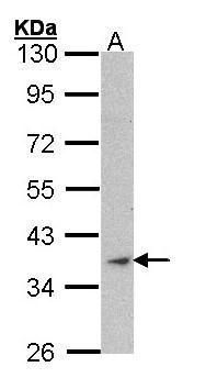 actin alpha 1, skeletal muscle Antibody