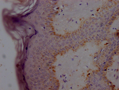 alpha Synuclein antibody