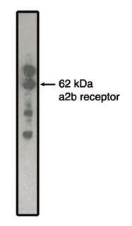 alpha2B Adrenergic Receptor antibody