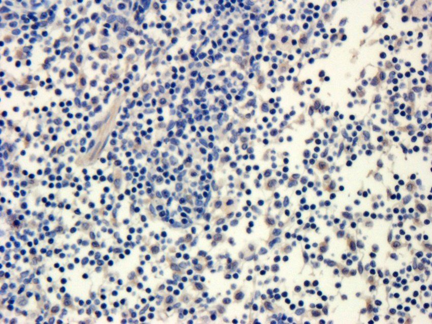 alpha 1 Antitrypsin antibody