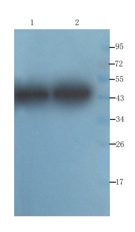 alpha 1 Antitrypsin antibody