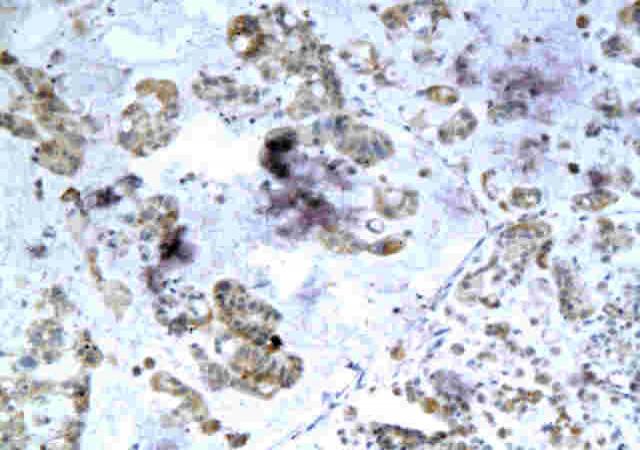 DEFA1/alpha Defensin 1 Rabbit Polyclonal Antibody