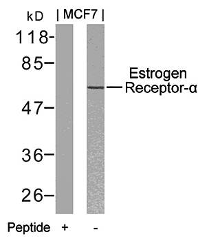 Estrogen Receptor-α (Ab06) Antibody