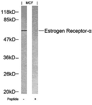 Estrogen Receptor-α (Ab18) Antibody