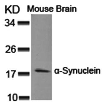 α-Synuclein (Ab25) Antibody