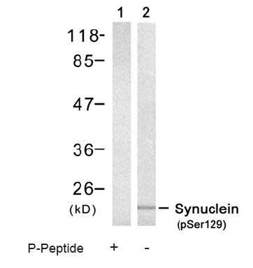 α-Synuclein (Phospho-Ser129) Antibody