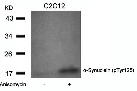 α-Synuclein (Phospho-Tyr125) Antibody