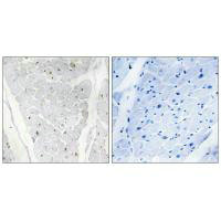 ALPK2 Antibody