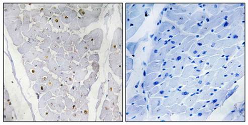 ALPK2 antibody