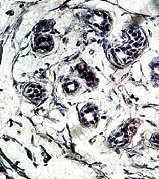 ALPK3 Rabbit Polyclonal Antibody