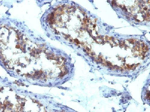ALPL Antibody