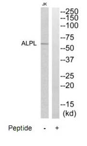 ALPL antibody