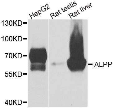 ALPP antibody