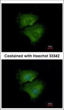 ALPPL2 Rabbit Polyclonal Antibody