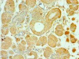 ALS2 Antibody