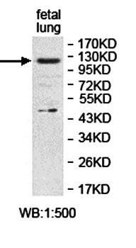 ALS2CL antibody