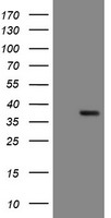 ALS2CR1 Antibody