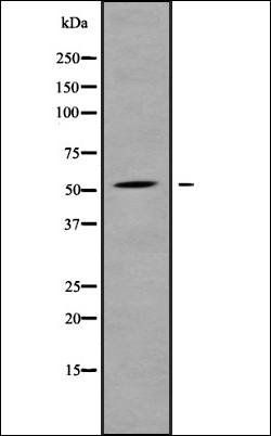 ALS2CR12 antibody