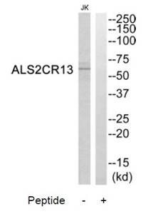 ALS2CR13 Antibody
