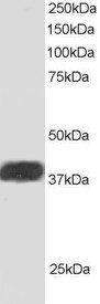 Goat anti-ALS2CR1 / NIF3L1 Antibody