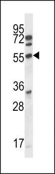 ALS2CR7 antibody