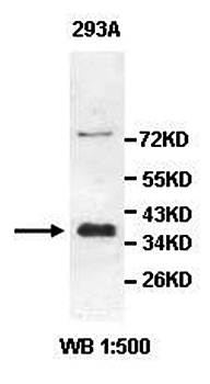 ALX3 Rabbit Polyclonal Antibody