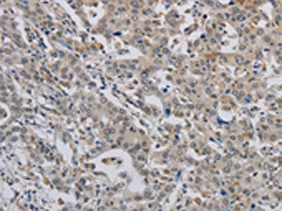 ALX4 Antibody