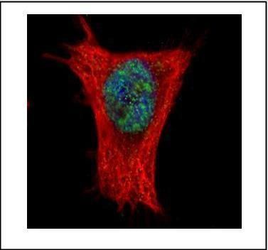 ALY Rabbit Polyclonal Antibody