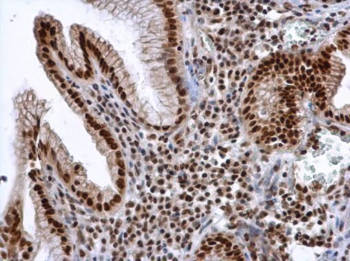 ALY Rabbit Polyclonal Antibody