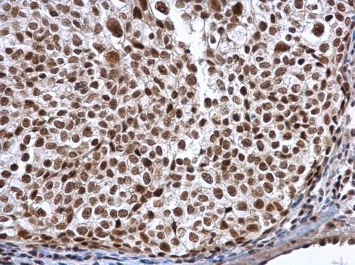 ALY Rabbit Polyclonal Antibody