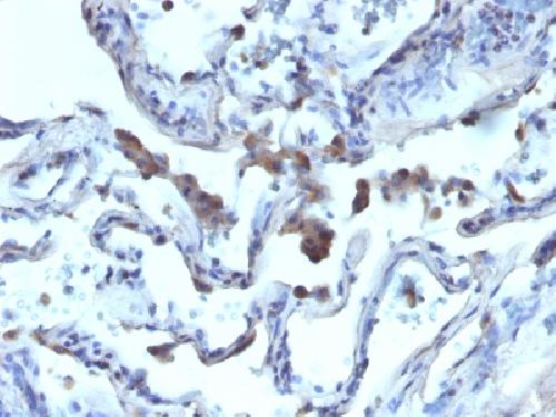 AMACR Antibody