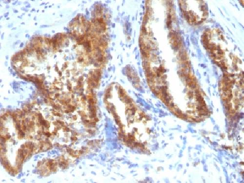 AMACR Antibody