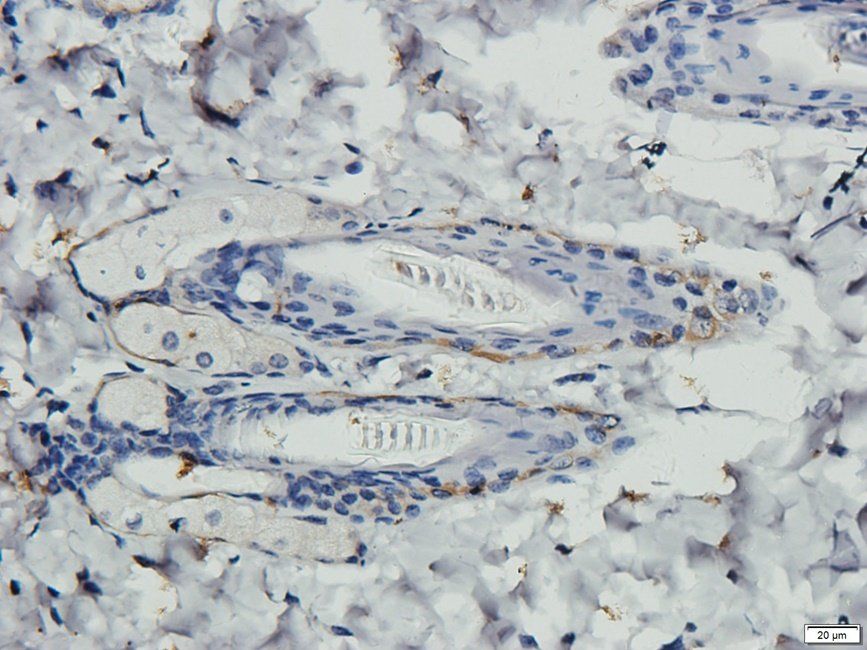 AMBP Rabbit Polyclonal Antibody