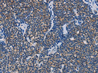 AMBRA1 Antibody