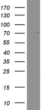 AMCase (CHIA) antibody