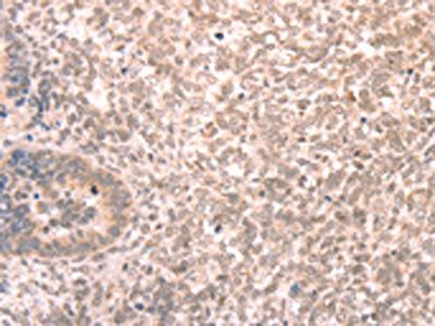 AMD1 antibody