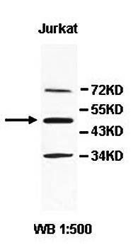 AMDHD1 antibody