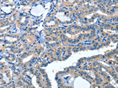 AMDHD2 antibody