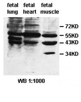AMDHD2 Rabbit Polyclonal Antibody