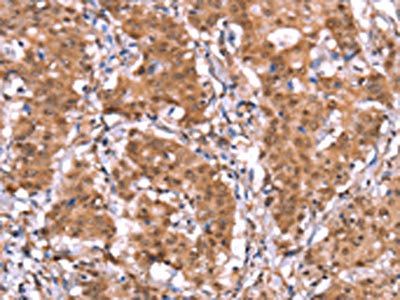 AMER1 antibody