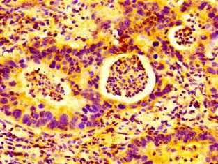 AMFR Antibody