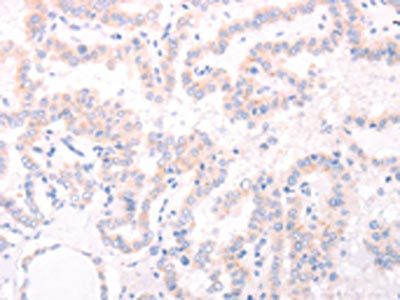 AMH Antibody