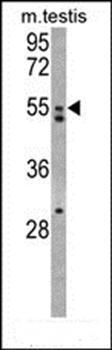 AMHR2 antibody