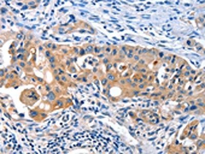 AMHR2 Antibody