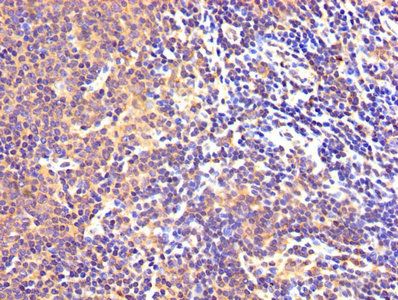 MAOB Antibody