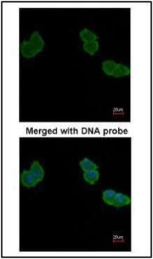 Aminoacylase 1 Rabbit Polyclonal Antibody