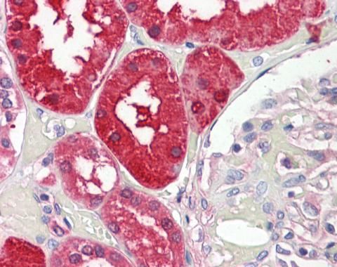 Aminoacylase 1 Rabbit Polyclonal Antibody